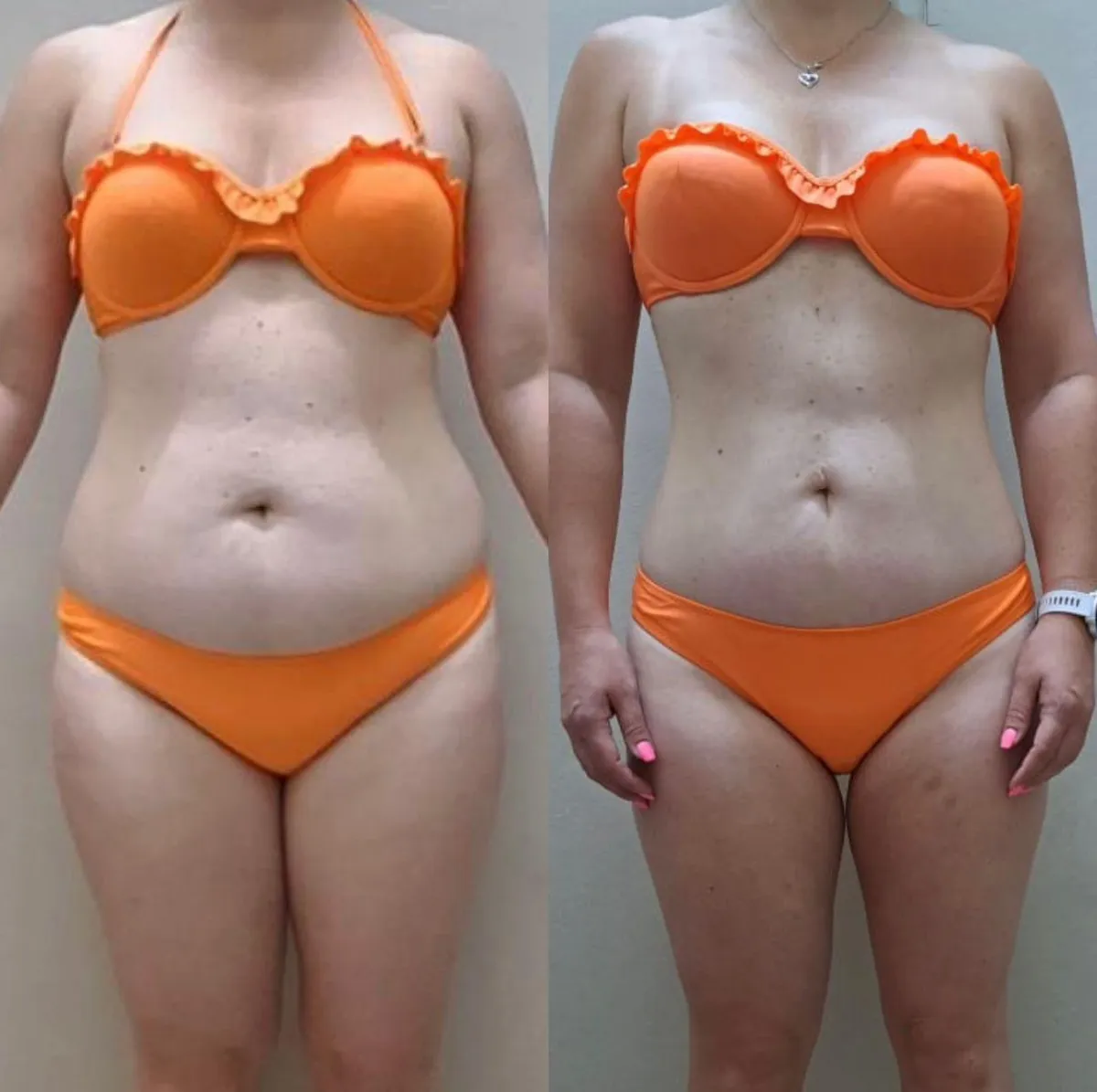 Landi before and after transformation
