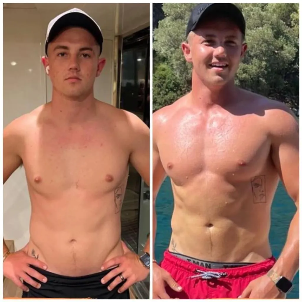 Hanré before and after transformation