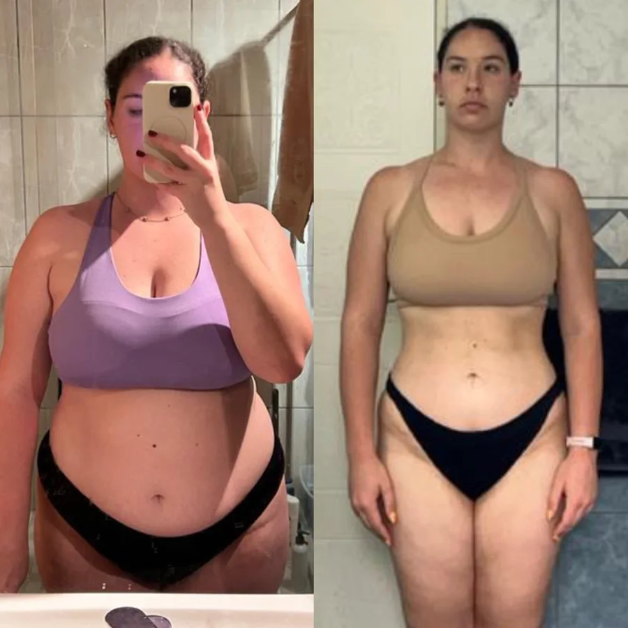 Neline transformation