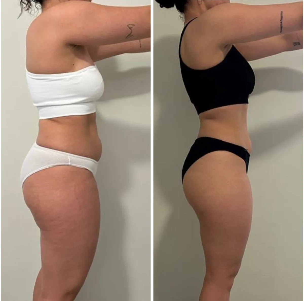Trinity before and after transformation