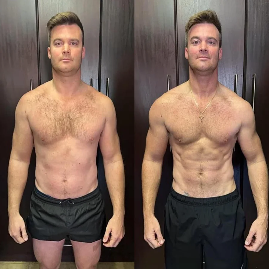 William transformation