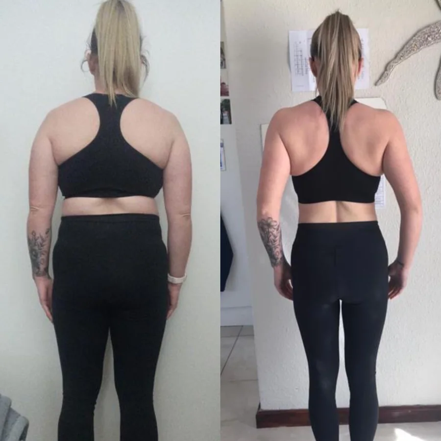 Alissa transformation